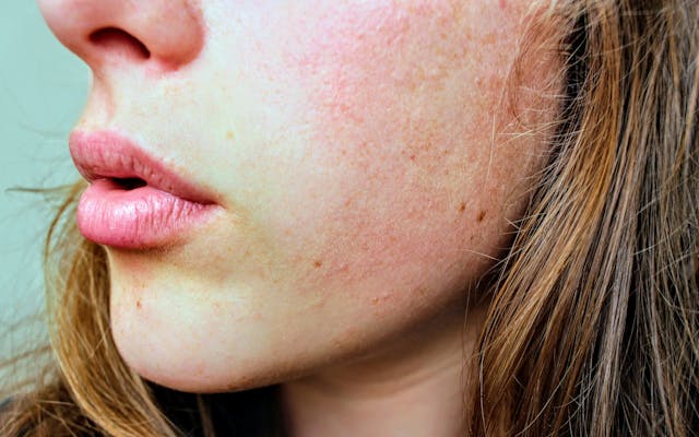sensitive skin or allergies sensitive skin or allergies
